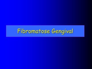 Fibromatose Gengival
 