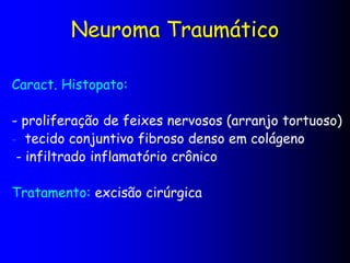 Neuroma Traumático
Caract. Histopato:
- proliferação de feixes nervosos (arranjo tortuoso)
- tecido conjuntivo fibroso denso em colágeno
- infiltrado inflamatório crônico
Tratamento: excisão cirúrgica
 