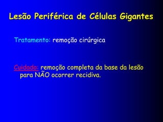Lesão Periférica de Células Gigantes
Tratamento: remoção cirúrgica
Cuidado: remoção completa da base da lesão
para NÃO ocorrer recidiva.
 