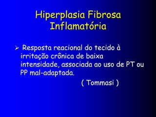 Hiperplasia Fibrosa
Inflamatória
 Resposta reacional do tecido à
irritação crônica de baixa
intensidade, associada ao uso de PT ou
PP mal-adaptada.
( Tommasi )
 