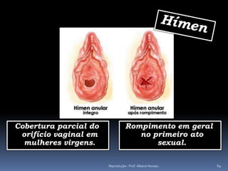 Cobertura parcial do             Rompimento em geral
 orifício vaginal em                no primeiro ato
  mulheres virgens.                     sexual.

                       Reprodução - Prof. Albano Novaes.   64
 