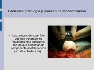 Pacientes, patología y proceso de monitorización
● Las prótesis de superficie
que han generado los
resultados más deficientes
son las que presentan un
componente acetabular con
arco de cobertura bajo
 