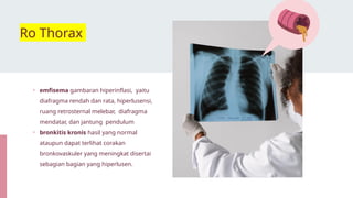 Ro Thorax
• emfisema gambaran hiperinflasi, yaitu
diafragma rendah dan rata, hiperlusensi,
ruang retrosternal melebar, diafragma
mendatar, dan jantung pendulum
• bronkitis kronis hasil yang normal
ataupun dapat terlihat corakan
bronkovaskuler yang meningkat disertai
sebagian bagian yang hiperlusen.
 