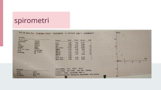 spirometri
 