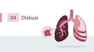 Diskusi
04
 