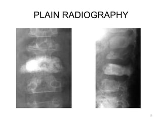 PLAIN RADIOGRAPHY
15
 