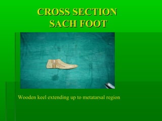 CROSS SECTIONCROSS SECTION
SACH FOOTSACH FOOT
Wooden keel extending up to metatarsal region
 