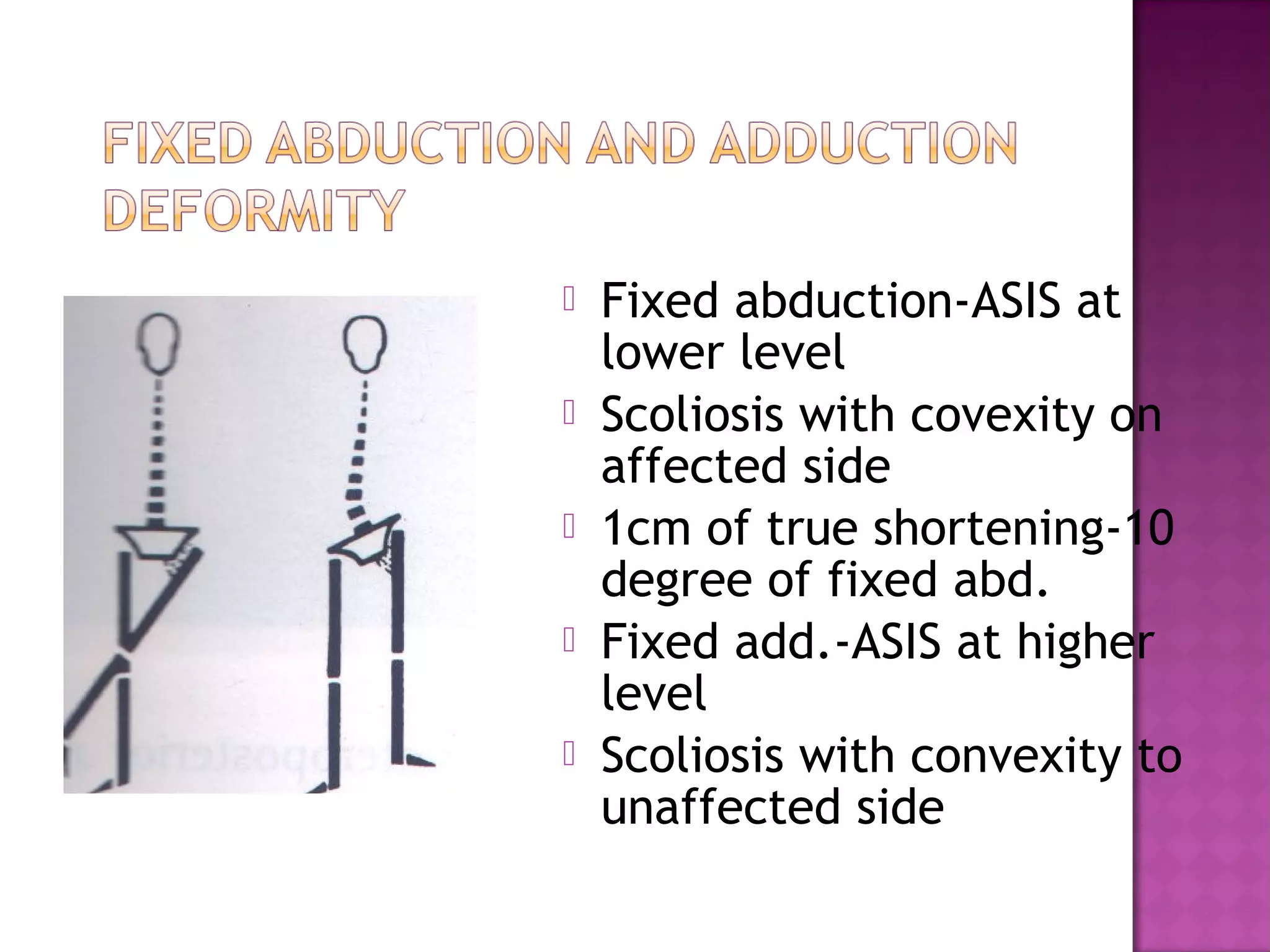    Fixed abduction-ASIS at
    lower level
   Scoliosis with covexity on
    affected side
   1cm of true shortening-10
    degree of fixed abd.
   Fixed add.-ASIS at higher
    level
   Scoliosis with convexity to
    unaffected side
 