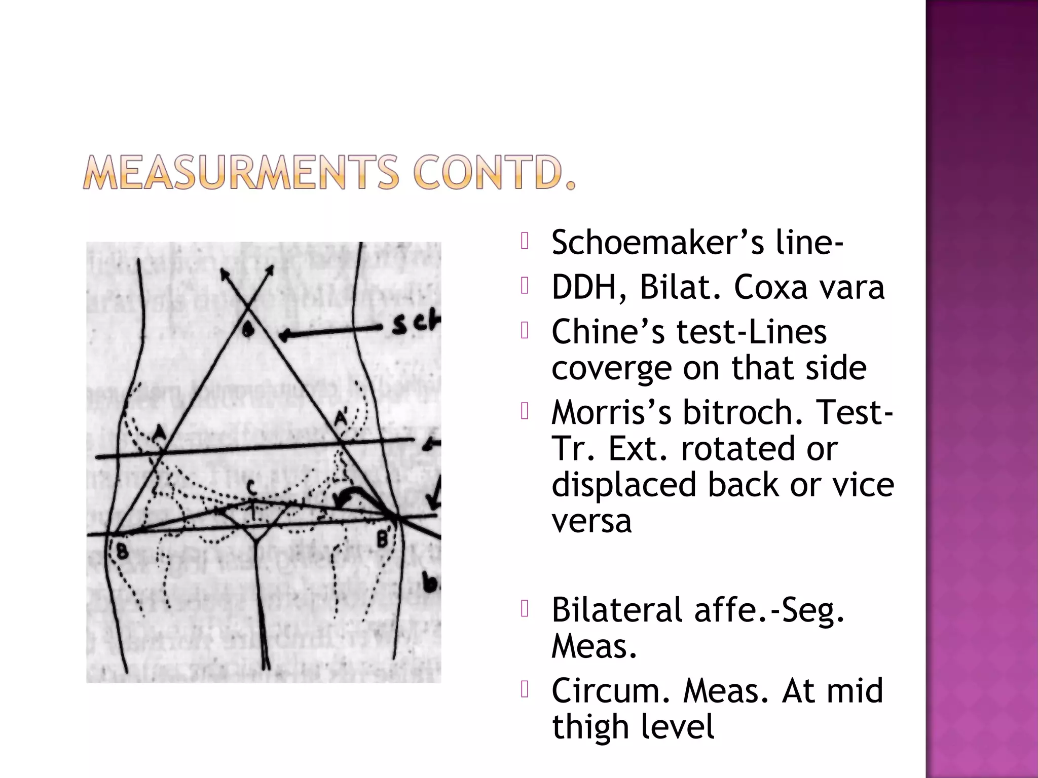    Schoemaker’s line-
   DDH, Bilat. Coxa vara
   Chine’s test-Lines
    coverge on that side
   Morris’s bitroch. Test-
    Tr. Ext. rotated or
    displaced back or vice
    versa

   Bilateral affe.-Seg.
    Meas.
   Circum. Meas. At mid
    thigh level
 