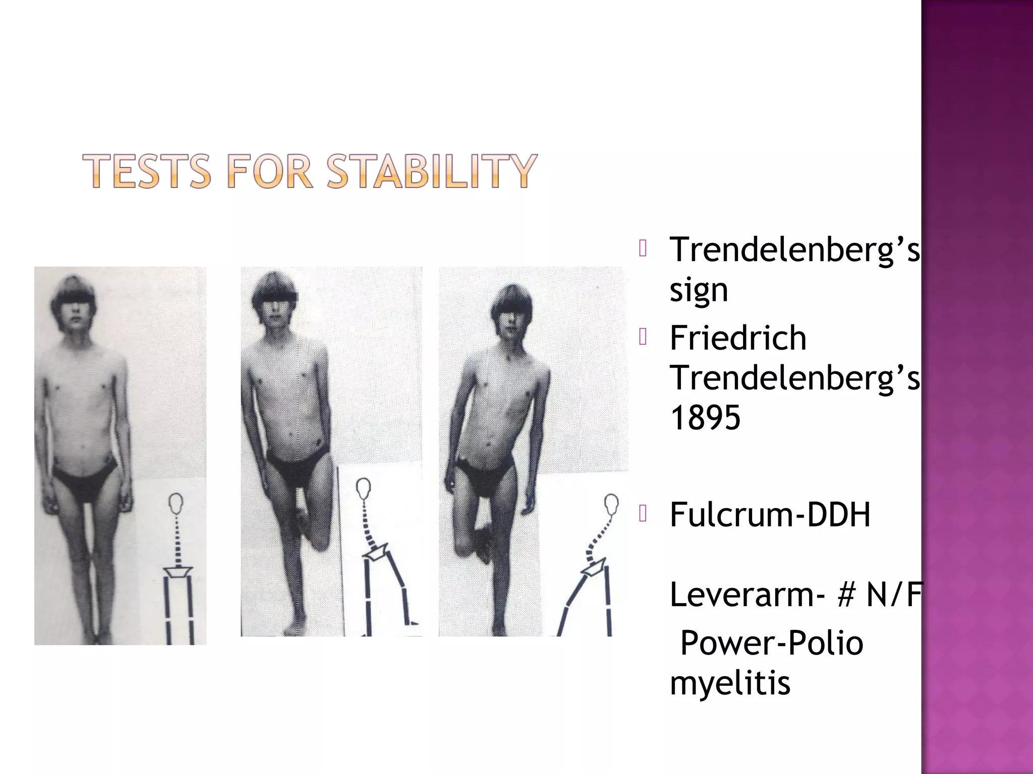    Trendelenberg’s
    sign
   Friedrich
    Trendelenberg’s
    1895

   Fulcrum-DDH

    Leverarm- # N/F
     Power-Polio
    myelitis
 