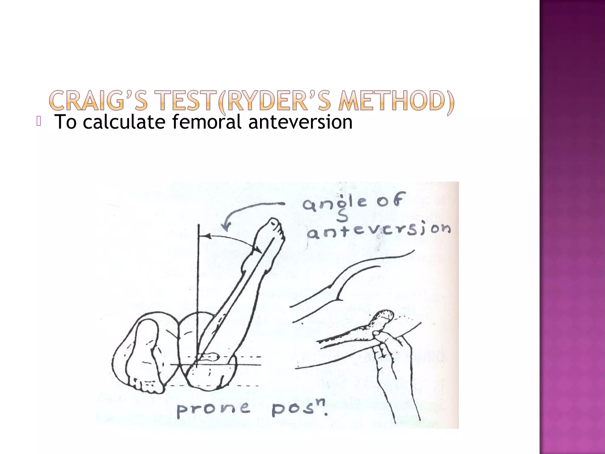    To calculate femoral anteversion
 