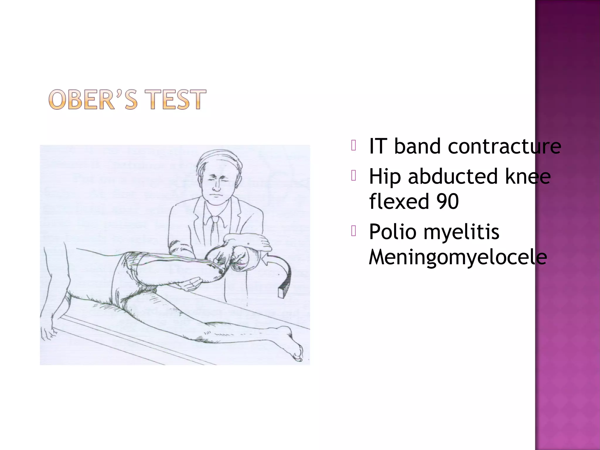    IT band contracture
   Hip abducted knee
    flexed 90
   Polio myelitis
    Meningomyelocele
 