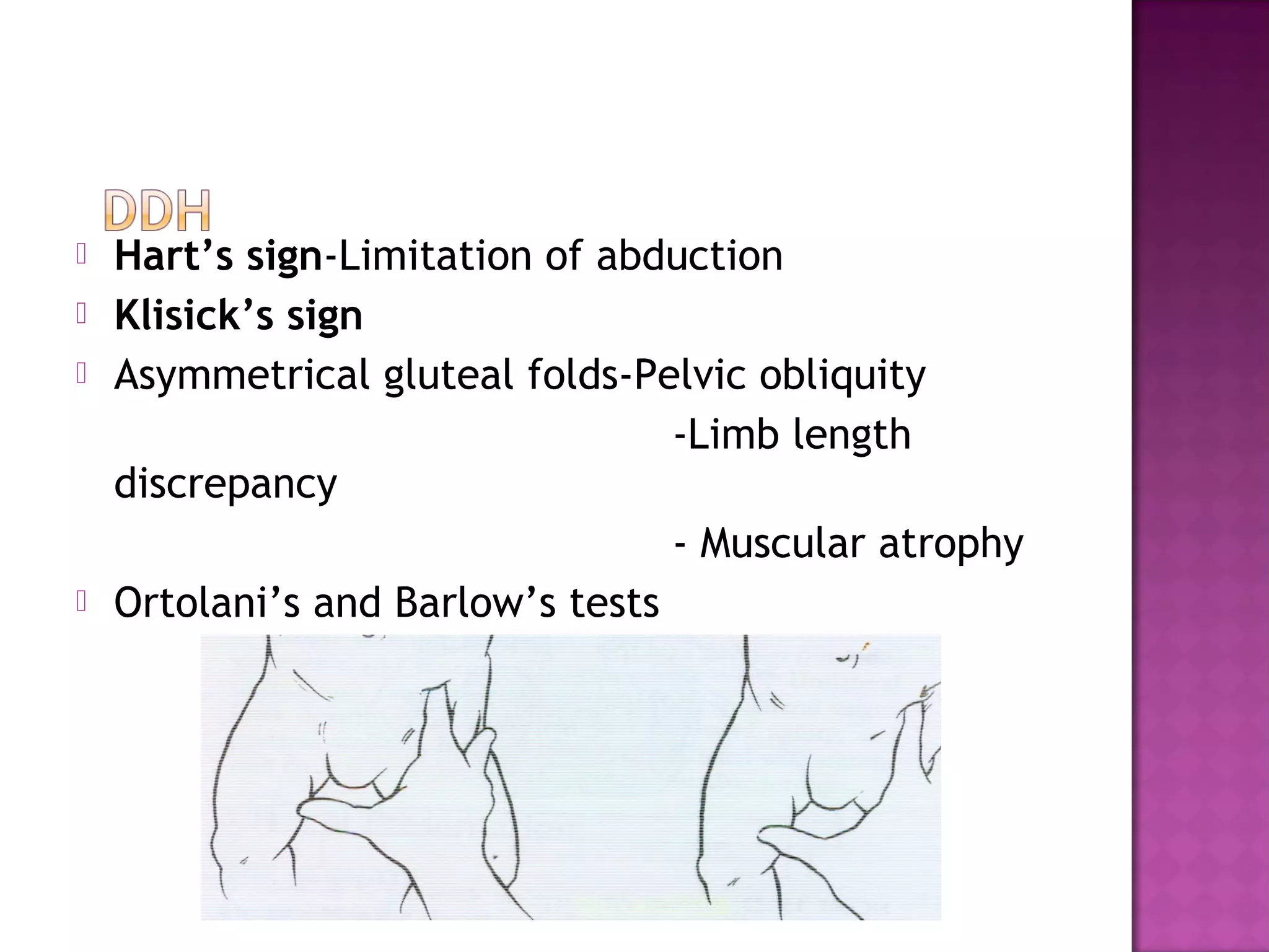    Hart’s sign-Limitation of abduction
   Klisick’s sign
   Asymmetrical gluteal folds-Pelvic obliquity
                                  -Limb length
    discrepancy
                                  - Muscular atrophy
   Ortolani’s and Barlow’s tests
 