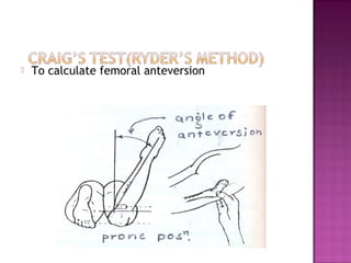    To calculate femoral anteversion
 