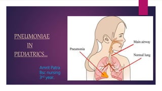 PNEUMONIAE
IN
PEDIATRICS…
Amrit Patra
Bsc nursing
3rd year..
 