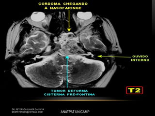 ANATPAT UNICAMP
DR. PETERSON XAVIER DA SILVA
MEDPETERSON@HOTMAIL.COM
 