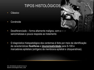 TIPOS HISTOLÓGICOS
• Clássico
• Condroide
• Desdiferenciado – forma altamente maligna, com características
sarcomatosas e pouca resposta ao tratamento
• O diagnóstico histopatológico dos cordomas é feito por meio da identificação
de características fisalíforas e imunorreatividade para S-100 e
marcadores epiteliais (antígeno de membrana epitelial e citoqueratinas).
DR. PETERSON XAVIER DA SILVA
MEDPETERSON@HOTMAIL.COM
 