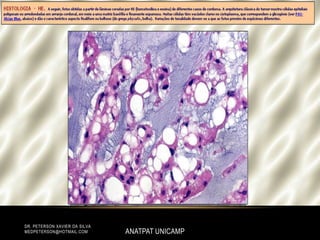 ANATPAT UNICAMP
DR. PETERSON XAVIER DA SILVA
MEDPETERSON@HOTMAIL.COM
 