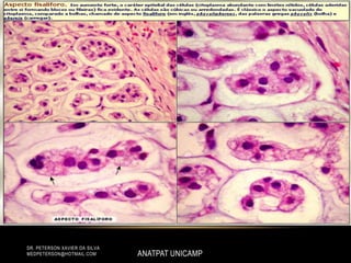 ANATPAT UNICAMP
DR. PETERSON XAVIER DA SILVA
MEDPETERSON@HOTMAIL.COM
 