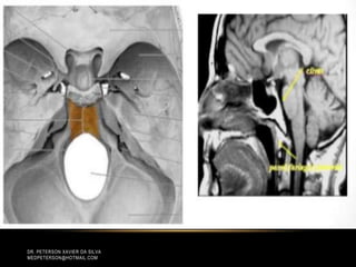 DR. PETERSON XAVIER DA SILVA
MEDPETERSON@HOTMAIL.COM
 