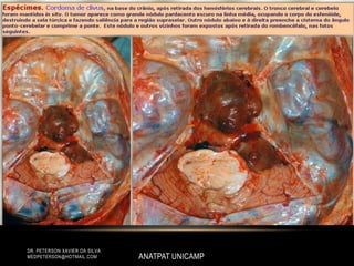 ANATPAT UNICAMP
DR. PETERSON XAVIER DA SILVA
MEDPETERSON@HOTMAIL.COM
 