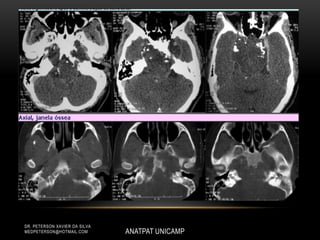 ANATPAT UNICAMP
DR. PETERSON XAVIER DA SILVA
MEDPETERSON@HOTMAIL.COM
 