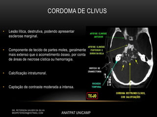 • Lesão lítica, destrutiva, podendo apresentar
esclerose marginal.
• Componente de tecido de partes moles, geralmente
mais extenso que o acometimento ósseo, por conta
de áreas de necrose cística ou hemorragia.
• Calcificação intratumoral.
• Captação de contraste moderada a intensa.
ANATPAT UNICAMP
DR. PETERSON XAVIER DA SILVA
MEDPETERSON@HOTMAIL.COM
CORDOMA DE CLIVUS
 