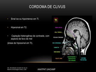 • Sinal iso ou hipointenso em Tl.
• Hipersinal em T2.
• Captação heterogênea de contraste, com
aspecto de favo de mel
(áreas de hipossinal em Tl).
ANATPAT UNICAMP
DR. PETERSON XAVIER DA SILVA
MEDPETERSON@HOTMAIL.COM
CORDOMA DE CLIVUS
 