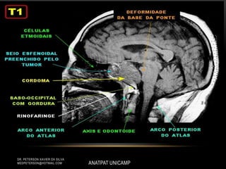ANATPAT UNICAMP
DR. PETERSON XAVIER DA SILVA
MEDPETERSON@HOTMAIL.COM
 