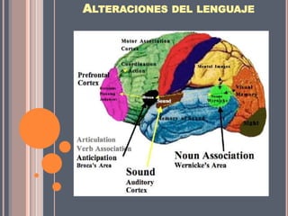 ALTERACIONES DEL LENGUAJE
 