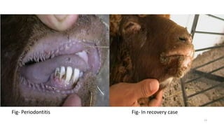 Fig- Periodontitis Fig- In recovery case
13
 