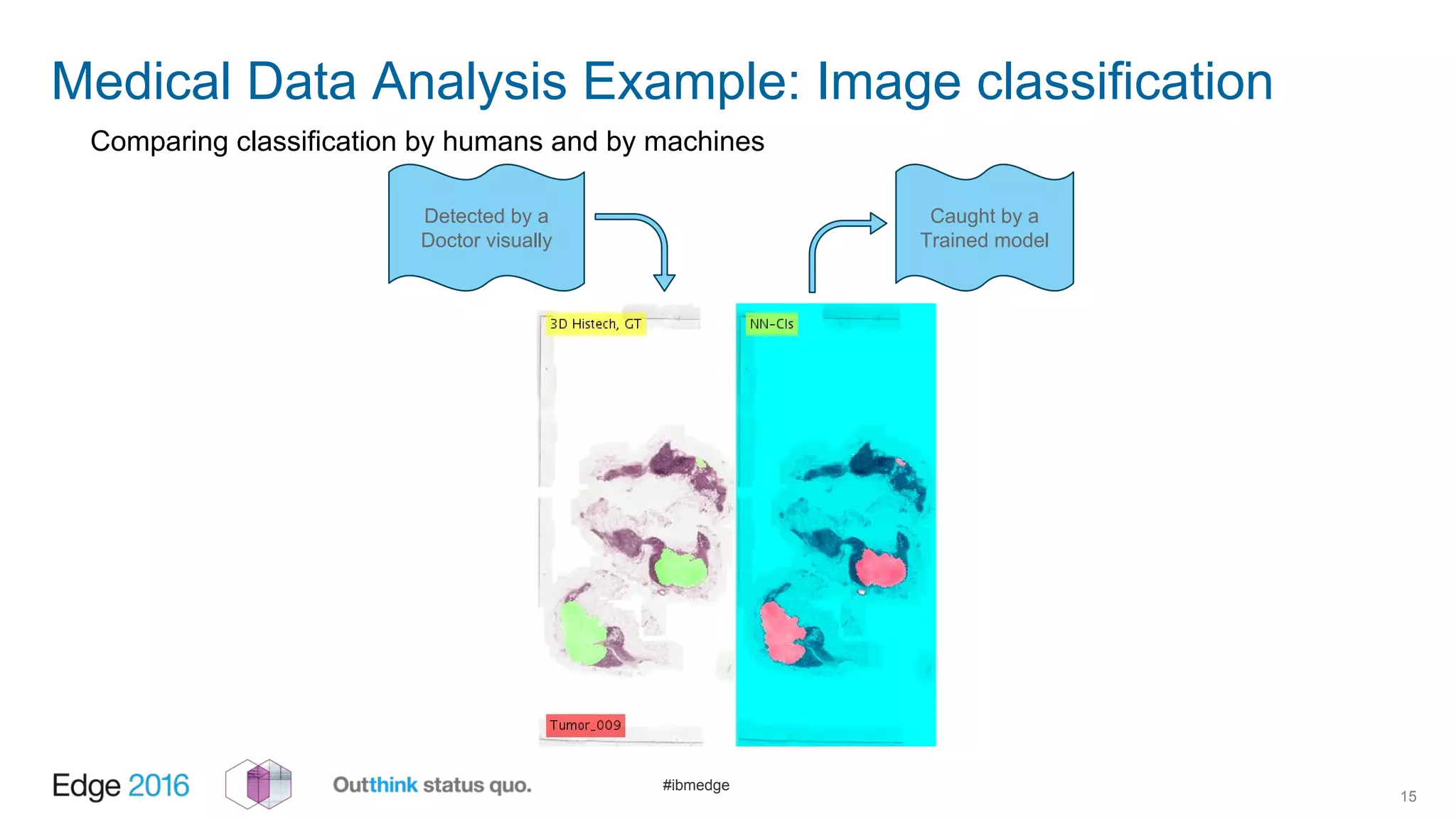 #ibmedge
15
Medical Data Analysis Example: Image classification
Comparing classification by humans and by machines
Detected by a
Doctor visually
Caught by a
Trained model
 