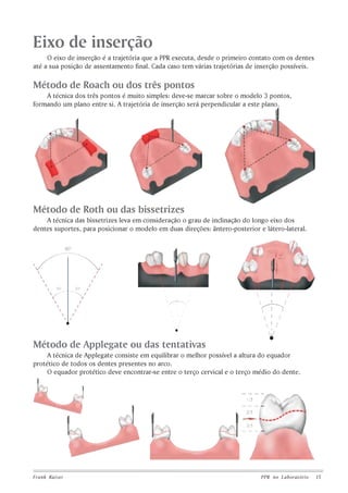 Eixo de inserção
O eixo de inserção é a trajetória que a PPR executa, desde o primeiro contato com os dentes
até a sua posição de assentamento final. Cada caso tem várias trajetórias de inserção possíveis.

Método de Roach ou dos três pontos
A técnica dos três pontos é muito simples: deve-se marcar sobre o modelo 3 pontos,
formando um plano entre si. A trajetória de inserção será perpendicular a este plano.

Método de Roth ou das bissetrizes
A técnica das bissetrizes leva em consideração o grau de inclinação do longo eixo dos
dentes suportes, para posicionar o modelo em duas direções: ântero-posterior e látero-lateral.

Método de Applegate ou das tentativas
A técnica de Applegate consiste em equilibrar o melhor possível a altura do equador
protético de todos os dentes presentes no arco.
O equador protético deve encontrar-se entre o terço cervical e o terço médio do dente.

Frank Kaiser

PPR no L aboratório

15

 