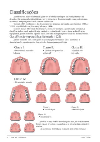 Classificações
A classificação dos desdentados ajuda-nos a estabelecer regras de planejamento e de
desenho. Ela tem uma função didática e serve como meio de comunicação entre profissionais,
facilitando a explicação de casos clínicos conhecidos.
Temos 64.534 combinações de desdentamento possíveis para cada arco (Cummer 1921), e
32.000 possibilidades de desenho (DeFranco, 1984).
Existem muitas diferentes classificações, como por exemplo a classificação universal, a
classificação funcional, a classificação mecânica, a classificação biomecânica, a classificação
topográfica, porém somente algumas delas têm uma real aplicação no dia-a-dia do laboratório.

Classificação topográfica (Kennedy 1925)
A mais utilizada, tem a vantagem da visualização imediata do caso, facilitando e
sistematizando planejamento e desenho das futuras peças protéticas.

Classe I:

Classe III:

• Desdentado posterior
unilateral

•Desdentado
intercalar

Classe I:
• Modificações

• Desdentado posterior
bilateral

Classe II:

Classe II:
• Modificações

Classe IV:
• Desdentado anterior

Classe III:
• Modificações
A Classe IV não admite modificações, pois, se existisse mais
de um espaço protético, enquadrar-se-ia em uma das outras três
Classes.
As classes de Kennedy se escrevem com letras romanas

2

PPR no Laboratório

Frank Kaiser

 