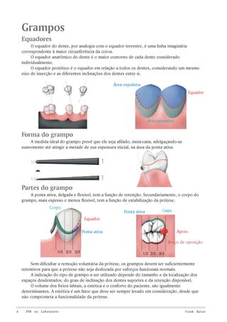 Grampos
Equadores
O equador do dente, por analogia com o equador terrestre, é uma linha imaginária
correspondente à maior circunferência da coroa.
O equador anatômico do dente é o maior contorno de cada dente considerado
individualmente.
O equador protético é o equador em relação a todos os dentes, considerando um mesmo
eixo de inserção e as diferentes inclinações dos dentes entre si.
Área expulsiva
Equador

Área retentiva

Forma do grampo
A medida ideal do grampo prevê que ele seja afilado, meia-cana, adelgaçando-se
suavemente até atingir a metade de sua espessura inicial, na área da ponta ativa.

Partes do grampo
A ponta ativa, delgada e flexível, tem a função de retenção. Secundariamente, o corpo do
grampo, mais espesso e menos flexível, tem a função de estabilização da prótese.
Corpo

Ponta ativa

Corpo

Equador
Ponta ativa

Apoio
Braço de oposição

Sem dificultar a remoção voluntária da prótese, os grampos devem ser suficientemente
retentivos para que a prótese não seja deslocada por esforços funcionais normais.
A indicação do tipo de grampo a ser utilizado depende do tamanho e da localização dos
espaços desdentados, do grau de inclinação dos dentes suportes e da retenção disponível.
O volume dos freios labiais, a estética e o conforto do paciente, são igualmente
determinantes. A estética é um fator que deve ser sempre levado em consideração, desde que
não comprometa a funcionalidade da prótese.
4

PPR no Laboratório

Frank Kaiser

 