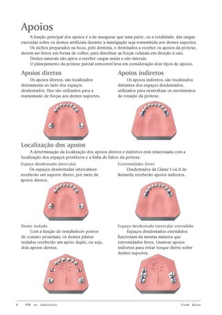 Apoios
A função principal dos apoios é a de assegurar que uma parte, ou a totalidade, das cargas
exercidas sobre os dentes artificiais durante a mastigação seja transmitida aos dentes suportes.
Os nichos preparados na boca, pelo dentista, e destinados a receber os apoios da prótese,
devem ser feitos em forma de colher, para distribuir as forças oclusais em direção à raiz.
Dentes naturais são aptos a receber cargas axiais e não laterais.
O planejamento da prótese parcial removível leva em consideração dois tipos de apoios.

Apoios diretos

Apoios indiretos

Os apoios diretos, são localizados
diretamente ao lado dos espaços
desdentados. Eles são utilizados para a
transmissão de forças aos dentes suportes.

Os apoios indiretos, são localizados
distantes dos espaços desdentados,
utilizados para neutralizar os movimentos
de rotação da prótese.

Localização dos apoios
A determinação da localização dos apoios diretos e indiretos está relacionada com a
localização dos espaços protéticos e a linha de fulcro da prótese.
Extremidades livres
Espaço desdentado intercalar
Os espaços desdentadas intercalares
Desdentados da Classe I ou II de
receberão um suporte direto, por meio de
Kennedy receberão apoios indiretos.
apoios diretos.

Dente isolado
Com a função de restabelecer pontos
de contato proximais, os dentes pilares
isolados receberão um apoio duplo, ou seja,
dois apoios diretos.

8

PPR no Laboratório

Espaço desdentado intercalar estendido
Espaços desdentados estendidos
funcionam da mesma maneira que
extremidades livres. Usam-se apoios
indiretos para evitar torque direto sobre
dentes suportes.

Frank Kaiser

 