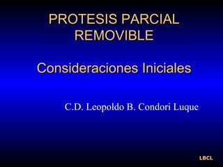 PROTESIS PARCIALPROTESIS PARCIAL
REMOVIBLEREMOVIBLE
Consideraciones InicialesConsideraciones Iniciales
C.D. Leopoldo B. Condori Luque
LBCL
 