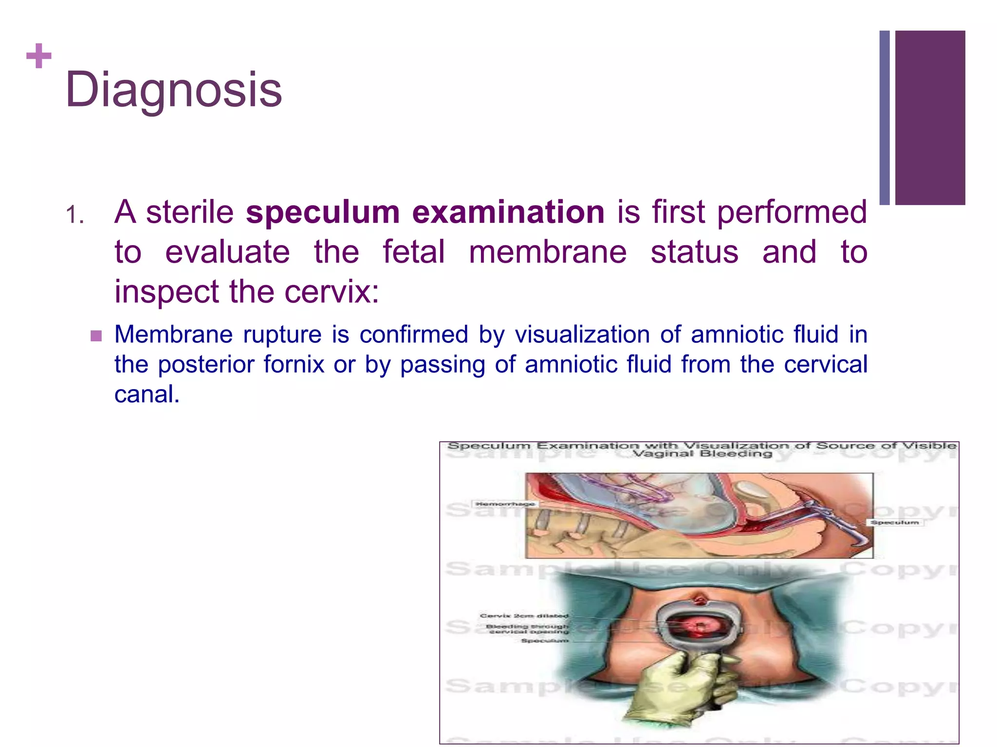 preterm-premature-rupture-of-membranes-pprom-ppt