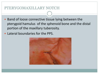 PTERYGOMAXILLARY NOTCH
 Band of loose connective tissue lying between the
pterygoid hamulus of the sphenoid bone and the distal
portion of the maxillary tuberosity.
 Lateral boundaries for the PPS.
 