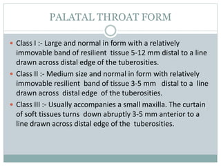 PALATAL THROAT FORM
 Class I :- Large and normal in form with a relatively
immovable band of resilient tissue 5-12 mm distal to a line
drawn across distal edge of the tuberosities.
 Class II :- Medium size and normal in form with relatively
immovable resilient band of tissue 3-5 mm distal to a line
drawn across distal edge of the tuberosities.
 Class III :- Usually accompanies a small maxilla. The curtain
of soft tissues turns down abruptly 3-5 mm anterior to a
line drawn across distal edge of the tuberosities.
 