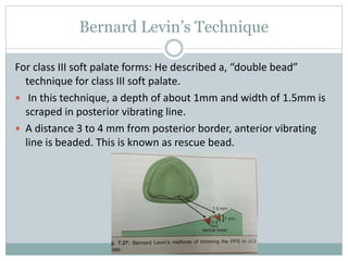 Bernard Levin’s Technique
For class III soft palate forms: He described a, “double bead”
technique for class III soft palate.
 In this technique, a depth of about 1mm and width of 1.5mm is
scraped in posterior vibrating line.
 A distance 3 to 4 mm from posterior border, anterior vibrating
line is beaded. This is known as rescue bead.
 