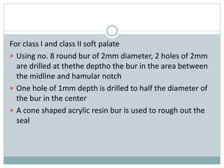For class I and class II soft palate
 Using no. 8 round bur of 2mm diameter, 2 holes of 2mm
are drilled at thethe deptho the bur in the area between
the midline and hamular notch
 One hole of 1mm depth is drilled to half the diameter of
the bur in the center
 A cone shaped acrylic resin bur is used to rough out the
seal
 