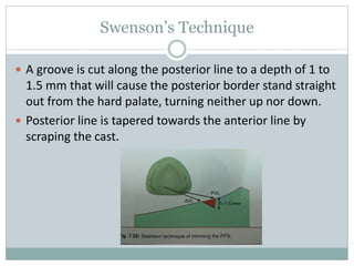 Swenson’s Technique
 A groove is cut along the posterior line to a depth of 1 to
1.5 mm that will cause the posterior border stand straight
out from the hard palate, turning neither up nor down.
 Posterior line is tapered towards the anterior line by
scraping the cast.
 