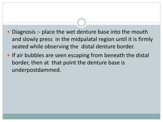  Diagnosis :- place the wet denture base into the mouth
and slowly press in the midpalatal region until it is firmly
seated while observing the distal denture border.
 If air bubbles are seen escaping from beneath the distal
border, then at that point the denture base is
underpostdammed.
 