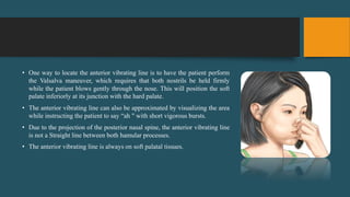 • One way to locate the anterior vibrating line is to have the patient perform
the Valsalva maneuver, which requires that both nostrils be held firmly
while the patient blows gently through the nose. This will position the soft
palate inferiorly at its junction with the hard palate.
• The anterior vibrating line can also be approximated by visualizing the area
while instructing the patient to say “ah " with short vigorous bursts.
• Due to the projection of the posterior nasal spine, the anterior vibrating line
is not a Straight line between both hamular processes.
• The anterior vibrating line is always on soft palatal tissues.
 