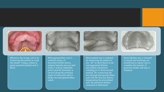 Remove the stringy saliva by
instructing the patient to wash
the mouth. Using a cotton or
gauze posterior palatal seal is
dried.
Pterygomaxillary seal is
outlined using a T-
burnisher/mouth mirror,
palpate hamular process and
mark it with an indeliable
pencil and the burnisher is
moved along the posterior
angle of tuberosity until it
drops into pterygomaxillary
notch.
Post palatal seal is outlined
by instructing the patient to
say “ah” in short bursts in an
unexaggerated fashion,
movement of posterior
vibrating lie is observed and
marked. By connecting the
line through pterygomaxillary
seal with the line just drawn,
demarcating the post palatal
seal, the posterior denture
extension is delineated.
Resin/Shellac tray is inserted
in mouth and markings are
transferred to master cast to
complete the transfer of
posterior border and tray is
trimmed.
 