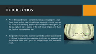 INTRODUCTION
 A well-fitting and retentive complete maxillary denture requires a well-
fitting tissue surface, a peripheral border compatible with the muscles
and tissues which make up the muco-buccal and muco-labial spaces, so
that a peripheral seal is created by the soft tissues draping over them
and finally, a posterior palatal seal.
 The posterior border of the maxillary denture has definite anatomic and
physiologic boundaries that, once understood, make the placement of
the posterior palatal seal a quick and easy procedure with predictable
results.
 