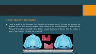 7.SILVERMAN’S TECHNIQUE
 Using a pencil a line is drawn from hamulus to hamulus midway between the anterior and
posterior flexion lines. Posterior flexion line is scored to one half deep of that of midscore line.
Anterior flexion line is marked with a shallow scratch. Deepness of the cast from the midline to
anterior and posterior vibrating line is tapered.
 