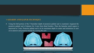 8.HARDYAND KAPUR TECHNIQUE
 Using the ball portion of the T burnisher depth of posterior palatal seal is examined. Augment the
posterior palatal seal of denture for 4 mm from distal borders. Then the hamular notch region is
narrowed to 2 mm. Posterior palatal seal is at its maximum depth in center and minimizes to zero
at its anterior and posterior border by scoring the cast.
 