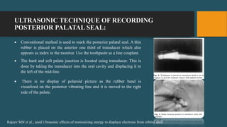 ULTRASONIC TECHNIQUE OF RECORDING
POSTERIOR PALATAL SEAL:
 Conventional method is used to mark the posterior palatal seal. A thin
rubber is placed on the anterior one third of transducer which also
appears as index in the monitor. Use the toothpaste as a line couplant.
 The hard and soft palate junction is located using transducer. This is
done by taking the transducer into the oral cavity and displacing it to
the left of the mid-line.
 There is no display of polaroid picture as the rubber band is
visualized on the posterior vibrating line and it is moved to the right
side of the palate.
Rajeev MN et al., used Ultrasonic effects of nonionizing energy to displace electrons from orbital shell
 